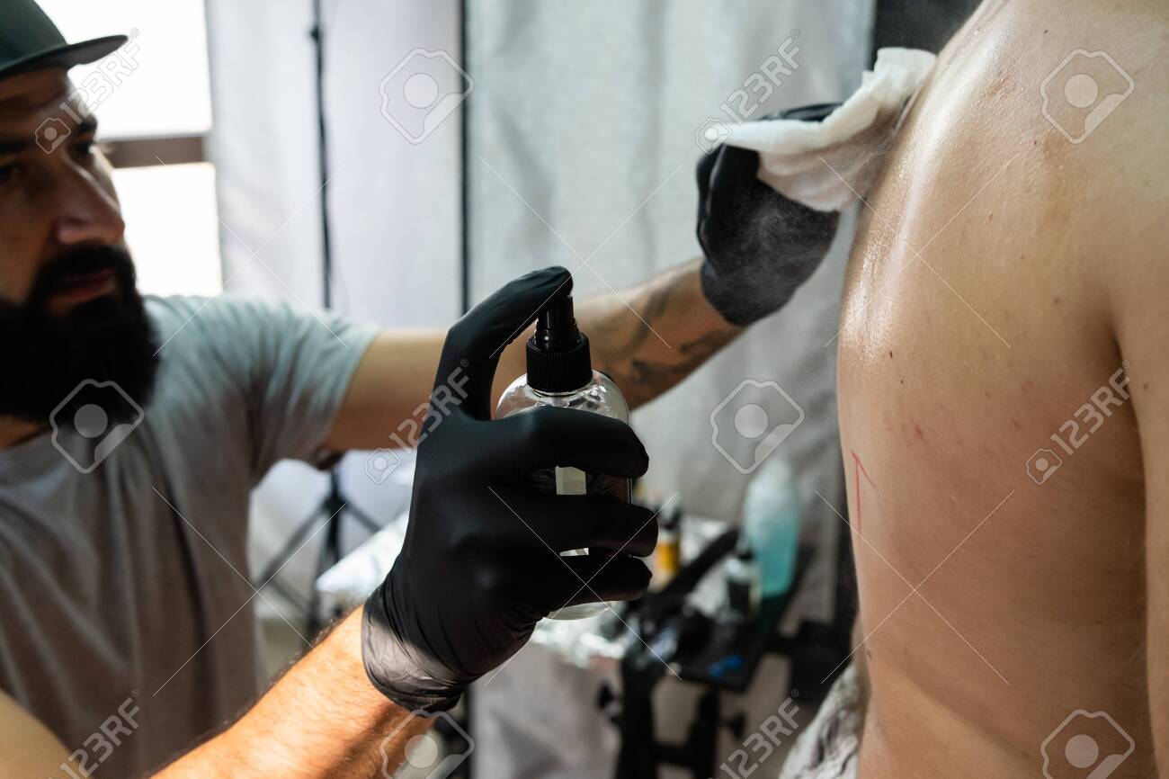 Tattoo Removal Options: Weighing the Pros and Cons