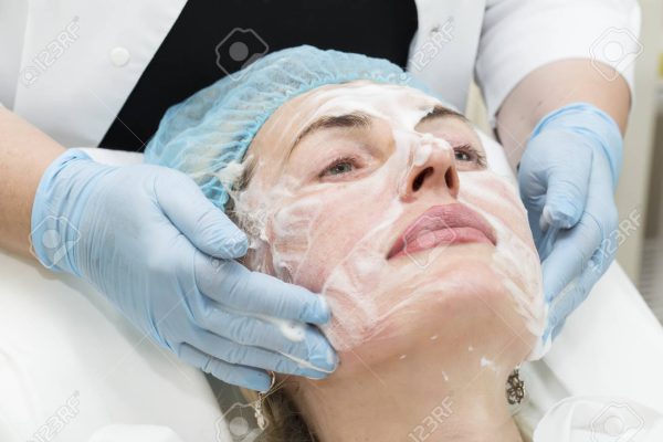 Microdermabrasion vs. Chemical Peels: Which Is Better?